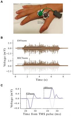 Reducing motor evoked potential amplitude variability through normalization